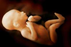 بالصور ..استئصال جنين من بطن مراهق حامل