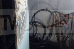 حريق مهول يشب بمركز جهاز الأشعة في مستشفى عين الدفلى