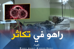 مرض سرطان الدم الليمفاوي يفتك بالجزائريين
