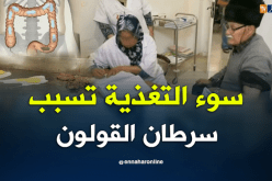 نقص المناعة بالجهاز الهضمي..سرطان القولون يهدد الجزائريين