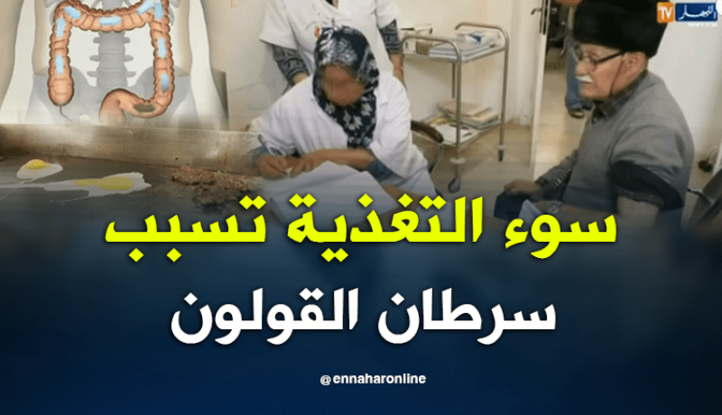 نقص المناعة بالجهاز الهضمي..سرطان القولون يهدد الجزائريين