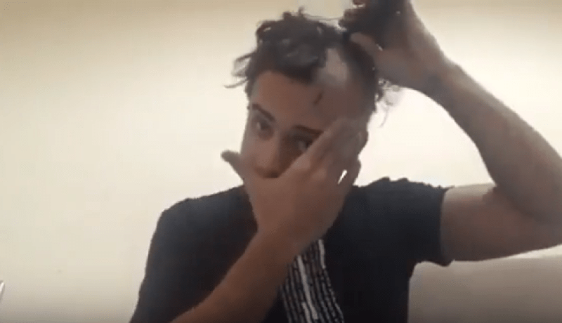 بالفيديو… فنان مصري يحلق شعره بسبب مريض بالسرطان