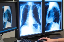 أخيرا ..صور أشعة ملوّنة تشخّص المرض بدقة عالية