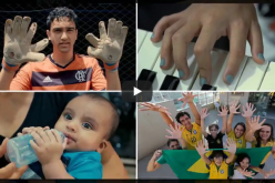 بالفيديو.. تشوّه خلقي يحوّل معاناة عائلة إلى الشهرة