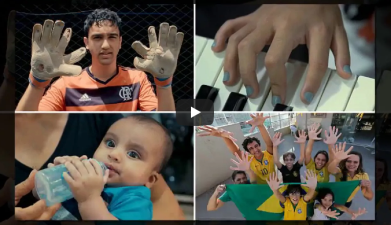 بالفيديو.. تشوّه خلقي يحوّل معاناة عائلة إلى الشهرة