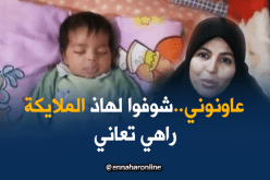 الطفلة لمار تعاني من مرض نادر وخطير.. وعائلتها تتنظر يد العون