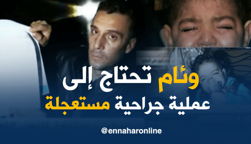 وئام تناشد المحسنين لإجراء عملية جراحية مستعجلة