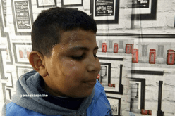 تلميذ يتيم الأب يتعرض للضرب من طرف معلمه في عين تموشنت
