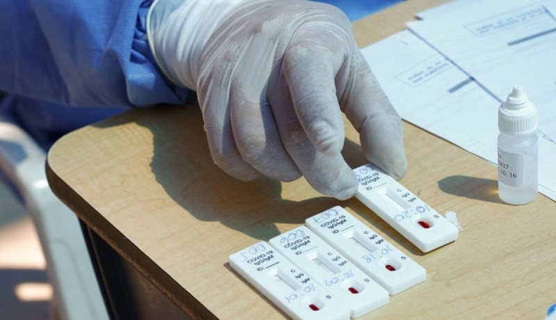 فرنسا.. إصابات “كورونا” فوق الـ 7 آلاف لليوم الثاني وغلق 22 مدرسة