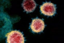 فريق الخبراء الصيني: كورونا بالجزائر مغاير للفيروس المُكتشف بالصين!