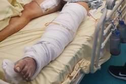 إهمال عيادة طبية خاصة يتسبّب في بتر ساق شاب عمره 21 سنة بوهران