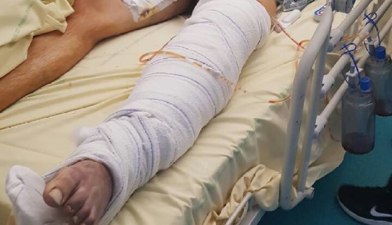 إهمال عيادة طبية خاصة يتسبّب في بتر ساق شاب عمره 21 سنة بوهران