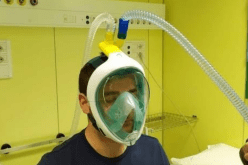 رئيس مصلحة الانعاش بالبليدة: إستعمال أقنعة الغطس أنقذ حياة  75 مصابا بكورونا