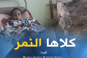 مستغانم: نمر يبتر يد طفلة صغيرة عمرها 8 سنوات بحديقة الحيوانات “موستا لاند “