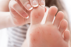 خبراء يكشفون عن أعراض جديدة غريبة للإصابة بفيروس كورونا