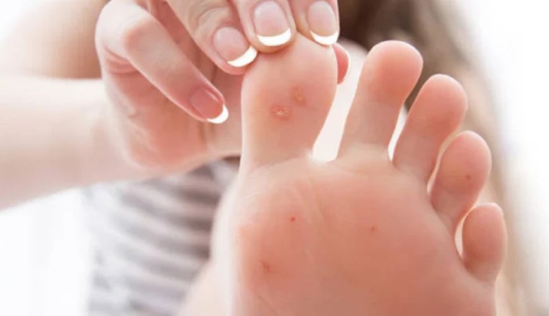 خبراء يكشفون عن أعراض جديدة غريبة للإصابة بفيروس كورونا