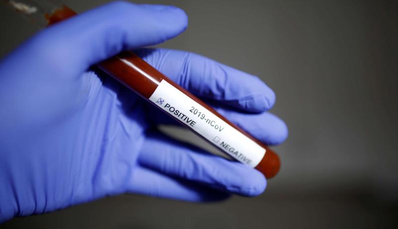 الصين: إرتفاع عدد وفيات كورونا إلى 1017 شخصا