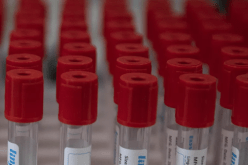 روسيا ترجّح تسجيل أول لقاح ضد كورونا في العالم خلال أيام