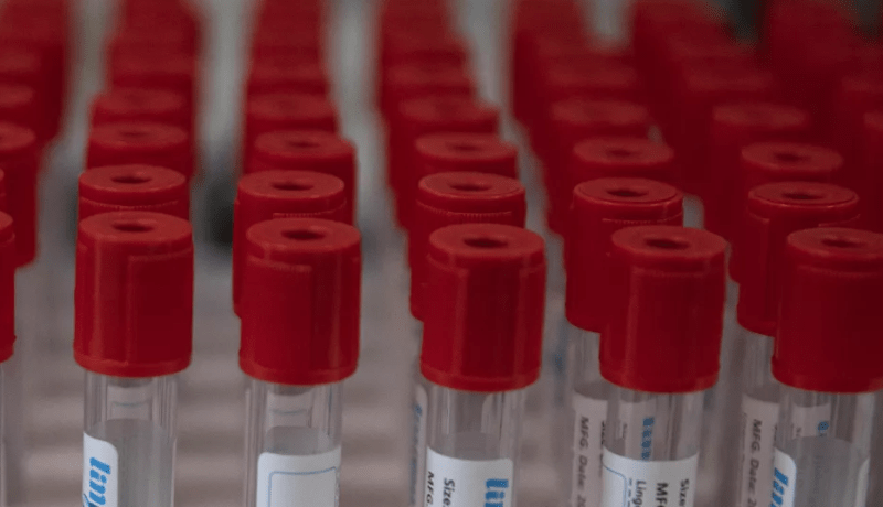 روسيا ترجّح تسجيل أول لقاح ضد كورونا في العالم خلال أيام