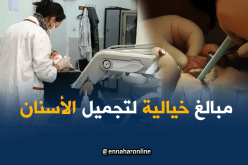هذا هو المبلغ الذي يصرفه الجزائريون لتجميل أسنانهم