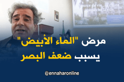 ملتقى علمي للتعريف بمرض “الماء الأبيض” الذي يصيب العيون بسطيف