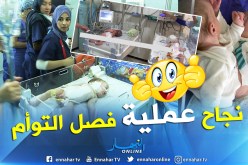 نجاح أول عملية لفصل توأم سيامي بالجزائر في مستشفى بلفور بالحراش