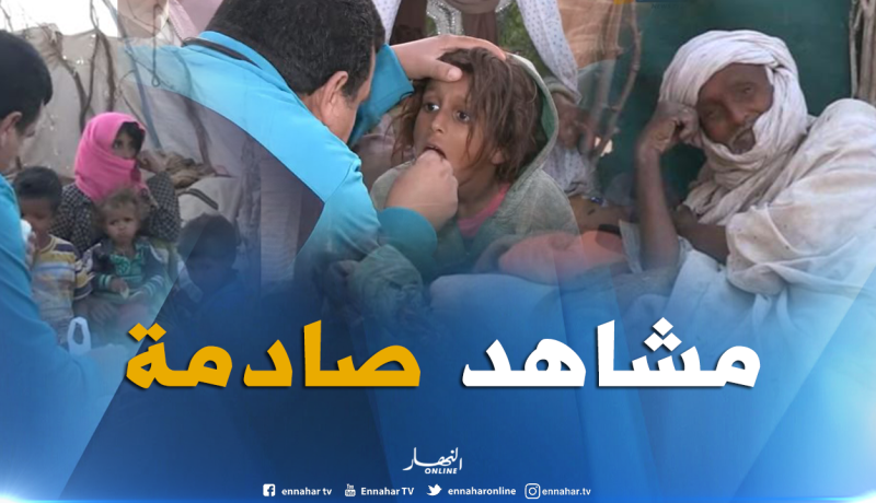 بالفيديو..إلتهاب الكبد الفيروسي يفتك بالبدو الرحل في صمت