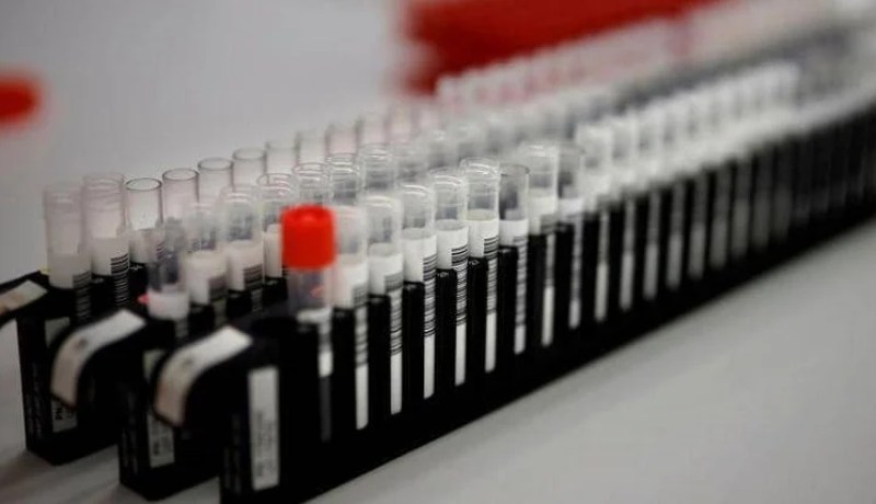 تطوير مادة معقمة تحمي بشدة من عدوى كورونا