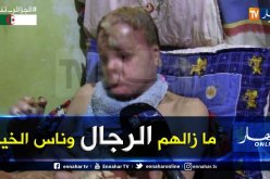 جيلالي مهري يتكفل بعلاج شاب ونفقات عائلته بعدما تحولت حياته إلى جحيم بسبب حروق في الجسد والوجه