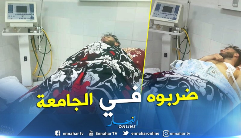 بالفيديو والصور.. مجهولون يعتدون على طالب بجامعة وهران2