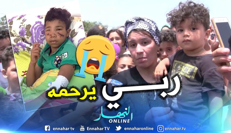 بالصور.. وفاة طفل من ضحايا عضات كلب مسعور بحي الكيمو في وهران