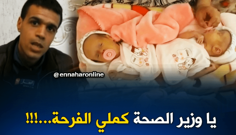 عائلة في ميلة ترزق بتوأم “سيامي”