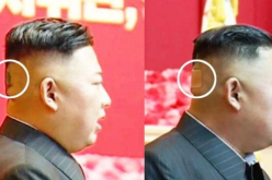 علامات غريبة تظهر على رأس زعيم كوريا الشمالية تثير الجدل