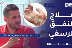 الصيف يحلى معنا/ متلازمة النفق الرسغي وطريقة علاجها