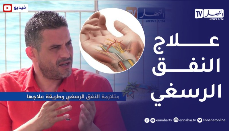 الصيف يحلى معنا/ متلازمة النفق الرسغي وطريقة علاجها