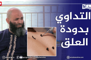 الصيف يحلى معنا / فوائد التداوي بدودة العلق