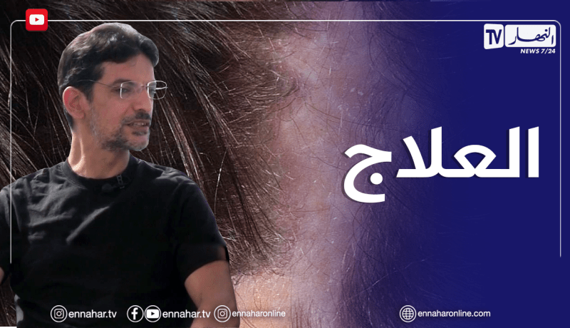 الصيف يحلى معنا/ إلتهاب فروة الرأس.. أسبابه وطريقة علاجه