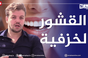 الصيف يحلى معانا: القشور الخزفية للأسنان تعالج العديد من المشاكل