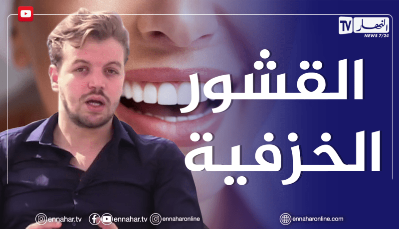 الصيف يحلى معانا: القشور الخزفية للأسنان تعالج العديد من المشاكل