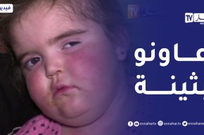 أم البواقي: “بثينة”..براءة بحاجة الى المساعدة لزرع النخاع العظمي