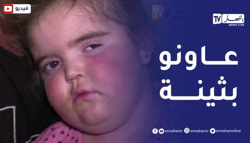 أم البواقي: “بثينة”..براءة بحاجة الى المساعدة لزرع النخاع العظمي