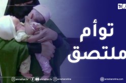 عائلة خرخار تستنجد السلطات لعلاج التوأم الملتصق في البطن