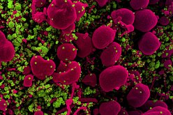 تحذير من متحور “مُتوحش” لكورونا قادم في الطريق