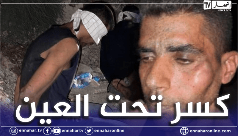 فلسطين.. نقل الأسير زكريا الزبيدي للمستشفى وهذه تفاصيل القبض عليه