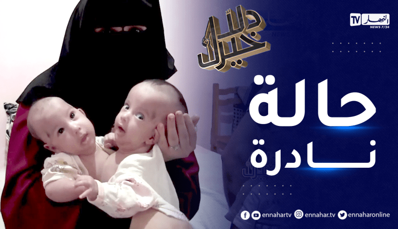 دلال خير: توأم بجسد واحد في حالة نادرة الحدوث وأمهم تناشد المحسنين وذوي الإختصاص للنظر في حالتهم