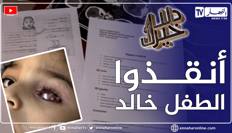 دلال خير: الطفل خالد.. أصيب بتعفن على مستوى العينين وفقد عينه اليسرى وهو في حاجة إلى جراحة مستعجلة