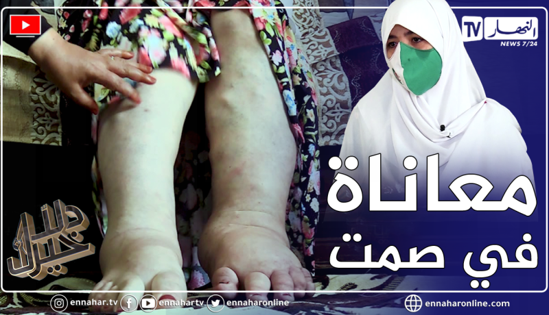 دلال خير: فتاة في ربيع العمر تروي تفاصيل معاناتها مع مـ.رض لازمها طيلة 24 عاما لكنها متمسكة بالأمل