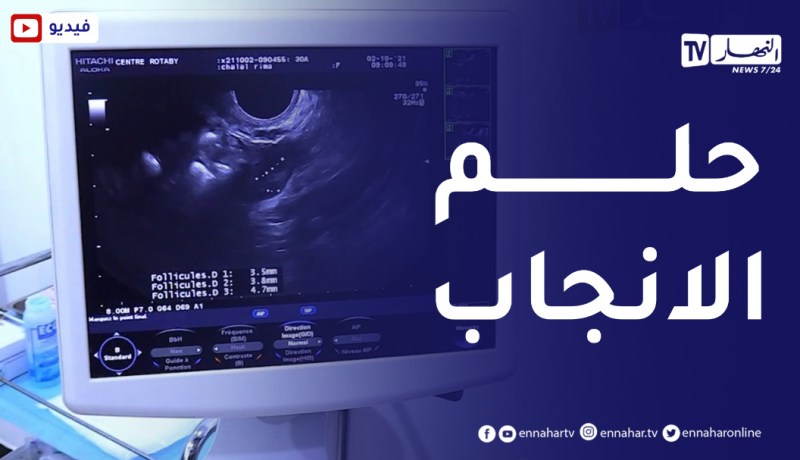 بعد تراجع الخصوبة..التلقيح المجهري وجهة أزواج لتحقيق حلم الإنجاب