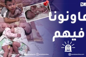 البليدة: صرخة والدين لفصل التوأمين..الطفلتين تعانيان من الفقر وأب شبه بطال