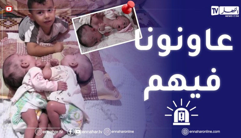 البليدة: صرخة والدين لفصل التوأمين..الطفلتين تعانيان من الفقر وأب شبه بطال